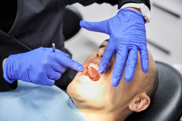 Best Emergency Treatment for Dental Infections or Abscesses in Hays, NC