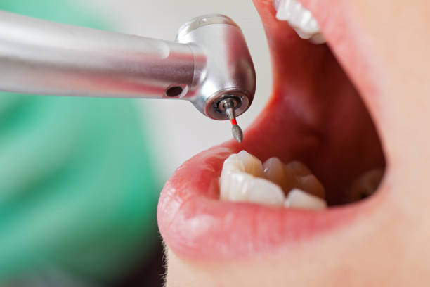 Best Emergency Tooth Extraction in Hays, NC